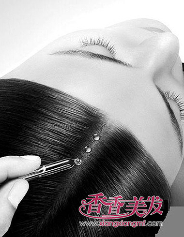 头皮屑多怎么办 六项预防与措施告别雪花纷飞