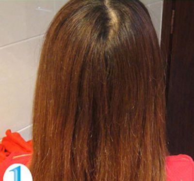 �޹��ߺɰ��̷� �ÿ��ĺɰ�ͷ