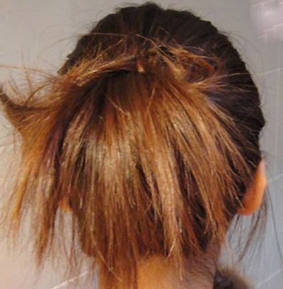 �޹��ߺɰ��̷� �ÿ��ĺɰ�ͷ