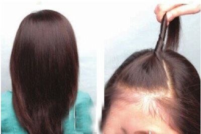 Сѧ����ͷ���Ĺ��� Сѧ����ͷ���ķ���