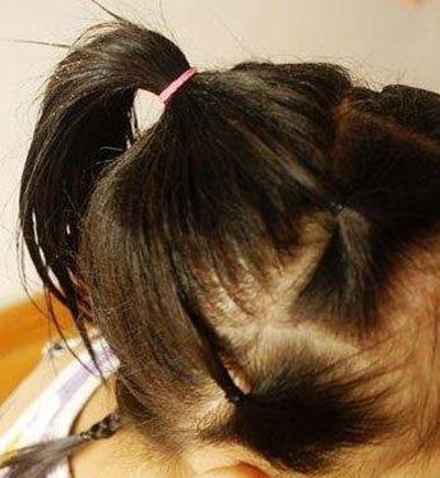 ��������ͯ����ͷ���� ��ͯ�����̷�����