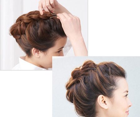 ͷ�϶������ɵ���������ʲô���� ���������췢������