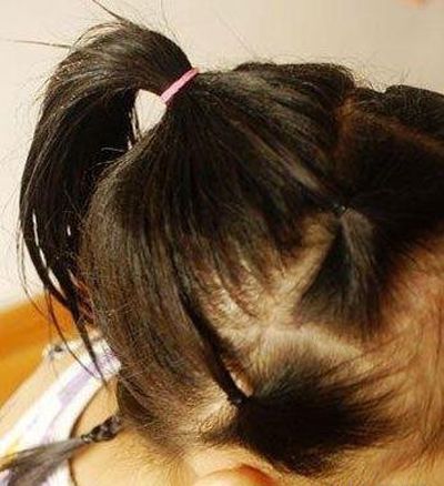 ��ͯ�̷���������ͼ�� ��ͯ�̷���������