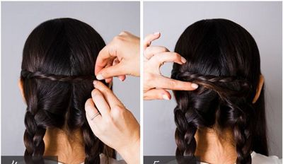 ͷ�����ʺ���ʲô���� ͷ������ô���̷���