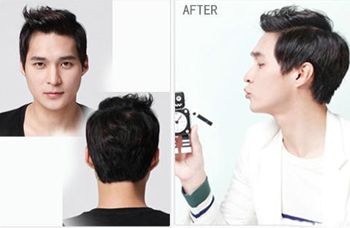 ����ͷ������ô������ ���߽����������̷�����