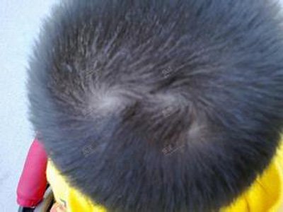 男孩三个旋发型图片 最阳光男发型