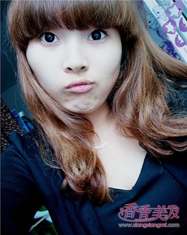 ͷ��ϡ��̫����ʲô�� ͷ���ر��ٺ�����ô��ͼƬ