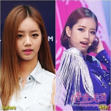 ǰ��ͷ���ٵ�Ů���ʺ�ʲô���� ͷ���ٵ����Ƿ���