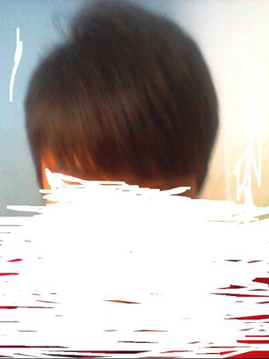 ����ͷ�������ܱ��ֶ�� ǰ��仯�к�Ч��