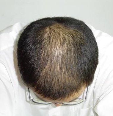 ����Ϊʲô����ͷ�� ����ͷ���ѷ���������