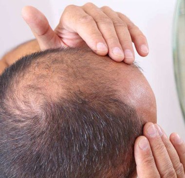 ����Ϊʲô����ͷ�� ����ͷ���ѷ���������