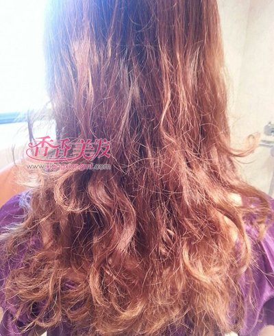 ͷ���ɿ�ë����ʲôС���� ͷ����ֹ����ë������������