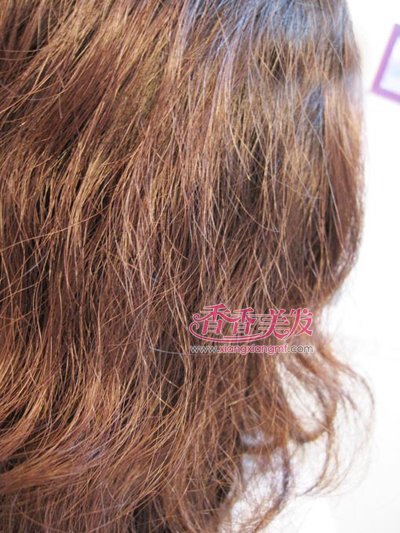 ͷ���ɿ�ë����ʲôС���� ͷ����ֹ����ë������������