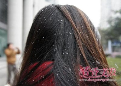 ������ͷƤм�ܶ�������ô�� ͷƤ��ͷм��С���а���ͷмso easy