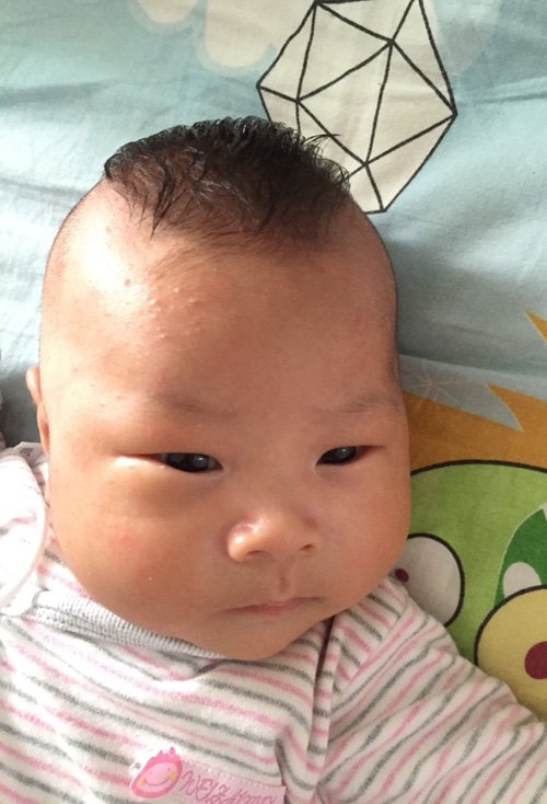 ��������������������ͷ��ȫ ������ѿ�Ķ�ͷ���������