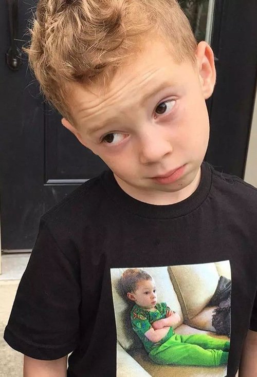 ��ͷ�к��ʺ�ʲô���� �����Ƥ�ɰ����к��̷�