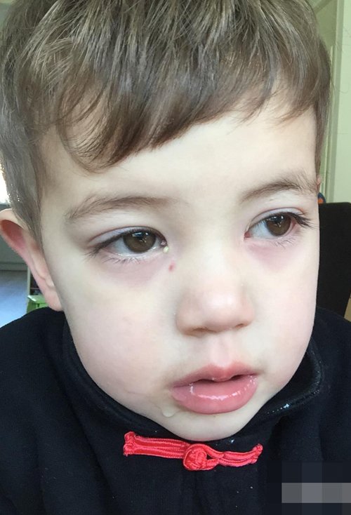 ����С���Ӽ���ͷ������ ���ȶȷ�һ���Ķ̾���